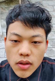 面筋哥|面筋哥确诊肺癌晚期！插呼吸管躺床上身形消瘦，称不知还能活几年