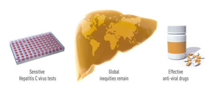 病毒|为什么丙肝病毒的发现能获诺奖？ 官方解读2020诺贝尔生理学或医学奖！