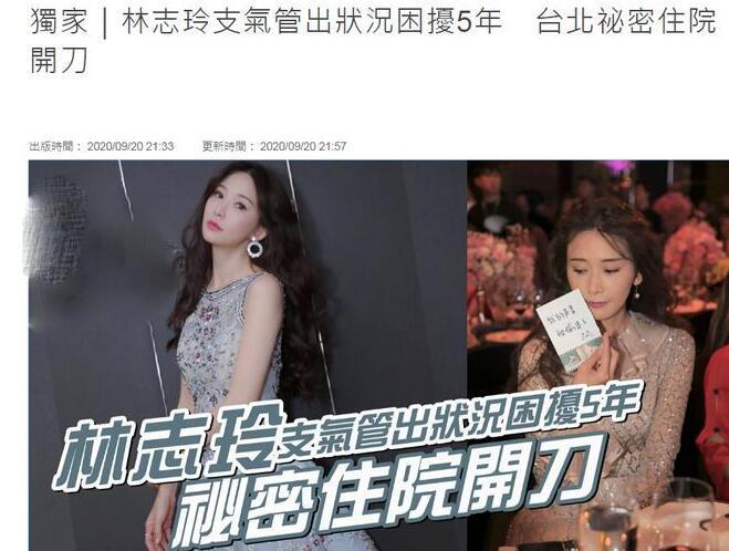 林志玲|林志玲手术后首露面，与朋友聚会气色红润，脸胖了好几圈