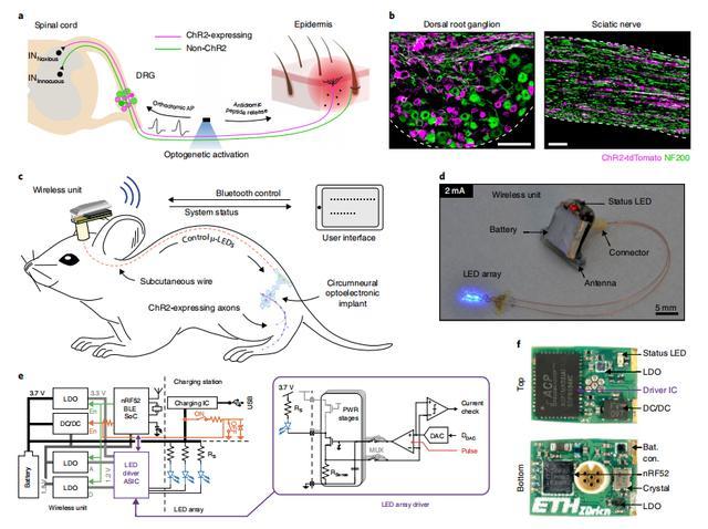 炎症|引发疼痛的感觉纤维是否能诱发炎症？新技术给出了答案