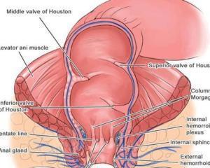 痔疮|十人九痔，十痔九不治？医生告诉你如何正确的治疗痔疮