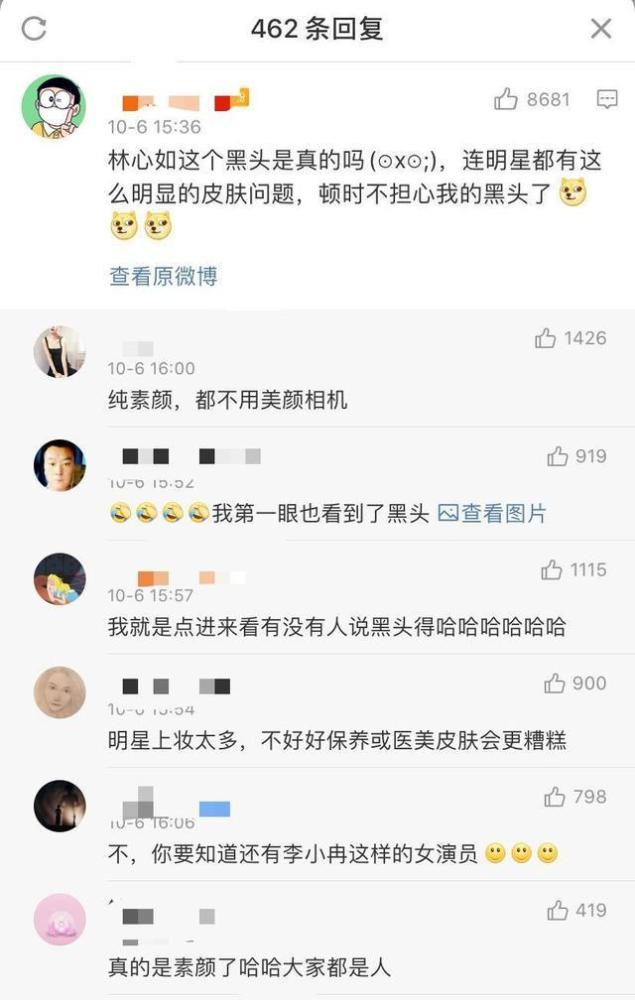 林心如|林心如晒自拍，黑头却成为热评第1，网友称还不如朱之文儿媳漂亮