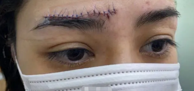 李爱琦|继阿娇后又一女星浴室滑倒，后脑勺撞地全身无法动弹