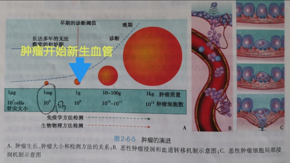 肺癌晚期，一種“餓死腫瘤”的治療方法。
