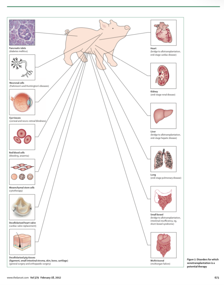异种移植|一头猪要如何拯救人类？异种移植从科学研究正走向临床治疗