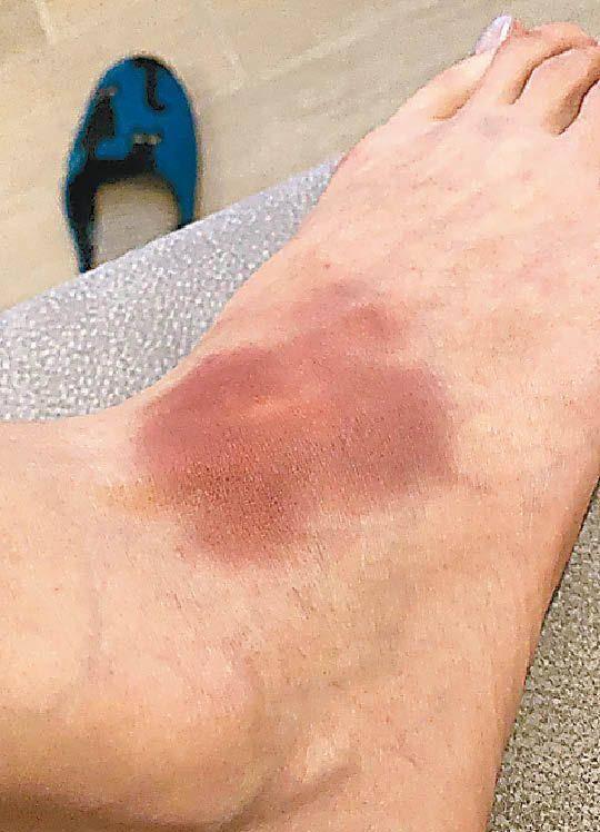 tvb新剧拳王将开拍姚子羚提前练泰拳做准备搞到脚淤青