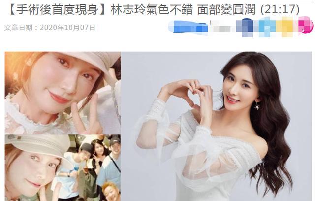林志玲|45岁林志玲手术后首现身！与众人聚会喜笑颜开，不见丈夫黑泽良平