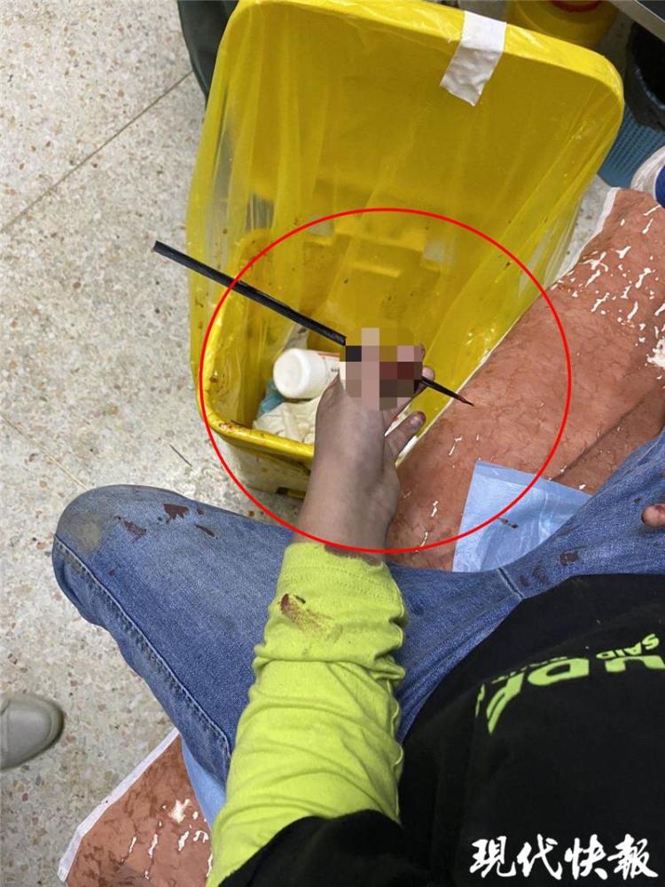 弓箭突然开裂,残箭刺穿男孩手指_腾讯新闻