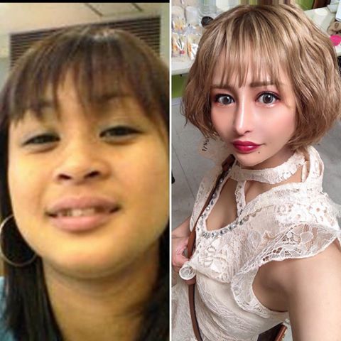 女子十年整容100次耗资2000万换脸成另一人