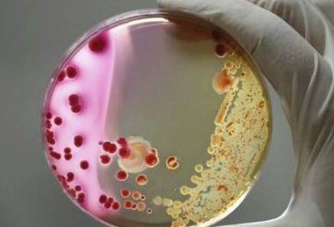 塑料垃圾|无意间拯救了地球？超级酶可快速分解塑料，人类有救了？