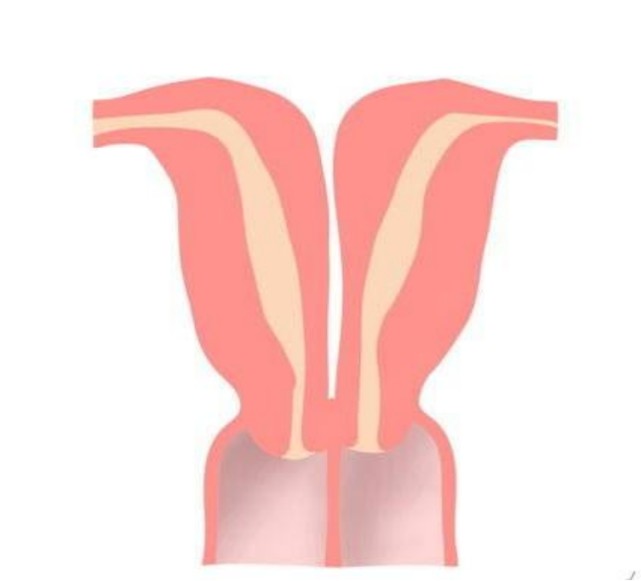 竟然有雙子宮的女人什麼原因引起的她還能正常生育嗎