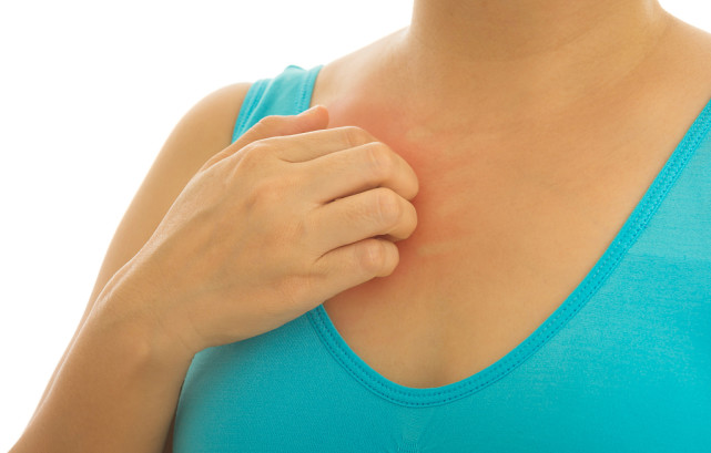 皮肤总瘙痒难耐？4个原因告诉你答案，别太晚知道了瘙痒过敏湿疹 