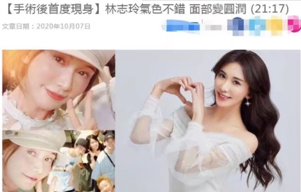 林志玲|林志玲术后和友人自拍状态好，曾被造谣家暴照流出与老公正式离婚