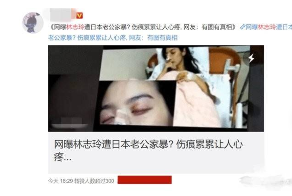 林志玲|林志玲术后和友人自拍状态好，曾被造谣家暴照流出与老公正式离婚