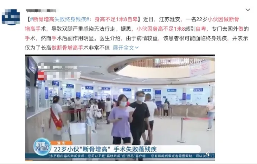 医生|矮真的会自卑？那些断骨增高的人，后来怎么样了？