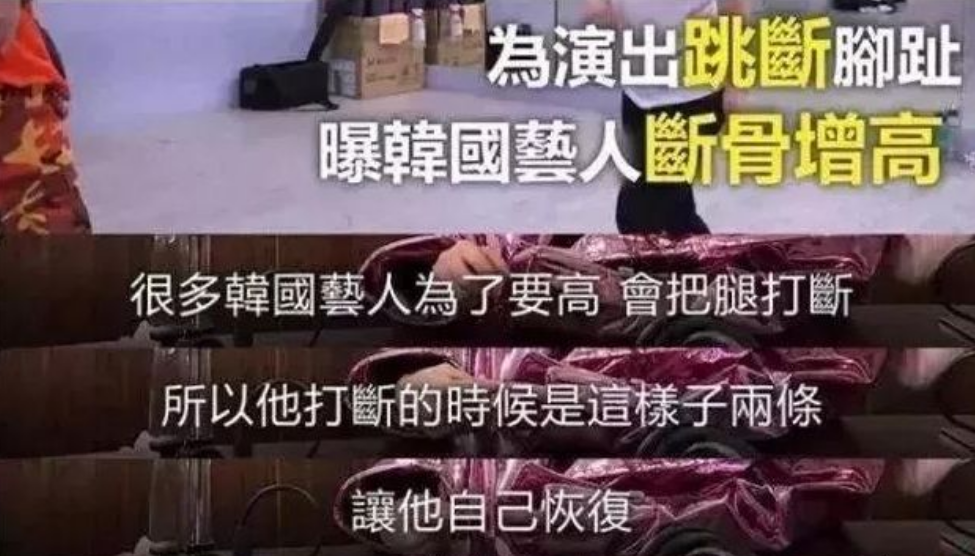 医生|矮真的会自卑？那些断骨增高的人，后来怎么样了？