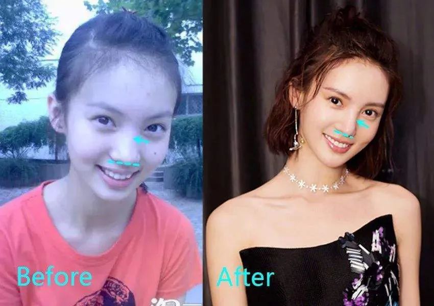 金晨|她终于傍上条粗腿了