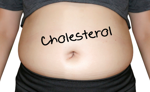 血脂|血脂正常，发现颈动脉斑块需要吃他汀吗？医生：还需评估后确定