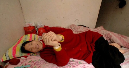 中国第一女巨人曾金莲14岁就比姚明还高遗体保留37年不火化