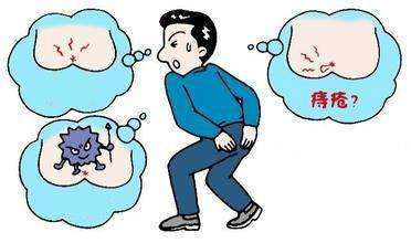 痔疮|得了痔疮怎么办？关于痔疮你想知道的事都在这