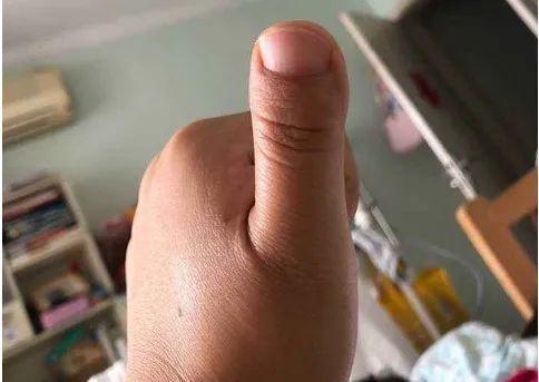 5. 拇指特征这是一个在许多人看来很有趣的特征.