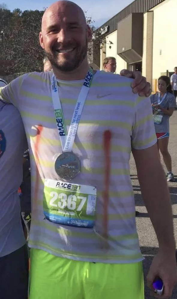 男人跑马拉松也要贴"乳贴"?不贴后果严重:会流血