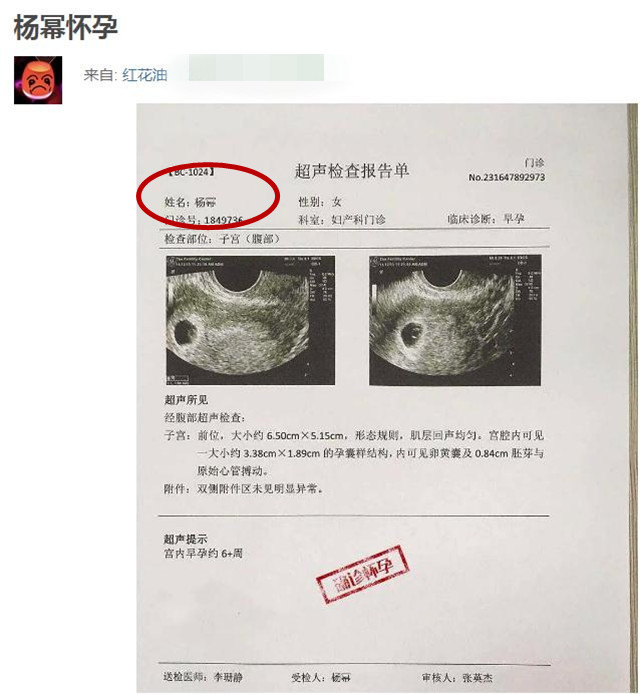 杨幂|传杨幂已怀孕B超单曝光，本尊穿8cm高跟鞋出席活动回应