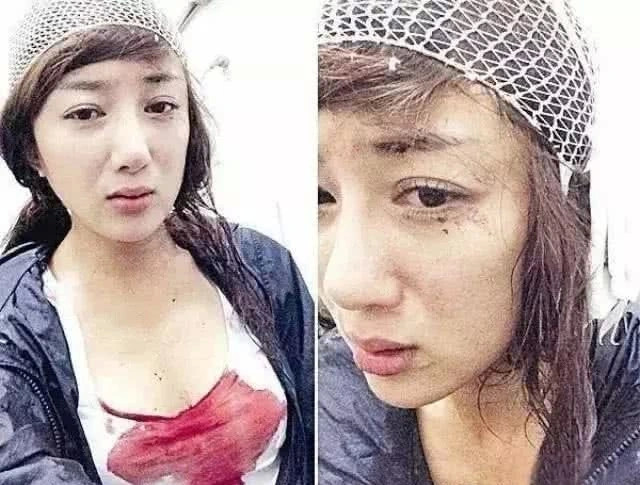 整容|她整容多次，曾被著名女星的狗咬毁容，如今搭档赵丽颖演技爆表！