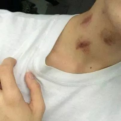 32岁男子,突然昏迷,抢救无效离世,医生分析诱因,妻子