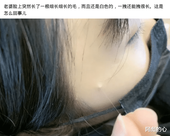 "老婆脸上突然长了一根细长的白毛,这是咋回事?