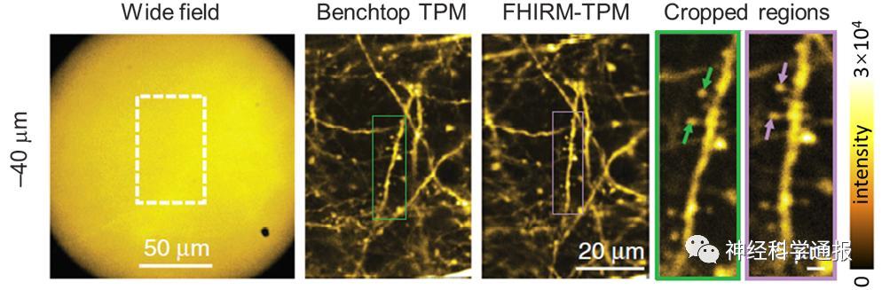 程和平|对话程和平团队：大国重器，窥视大脑的奥秘