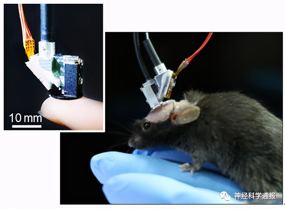 程和平|对话程和平团队：大国重器，窥视大脑的奥秘