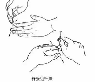 揭开针灸的神秘面纱想学和初识针灸的必看