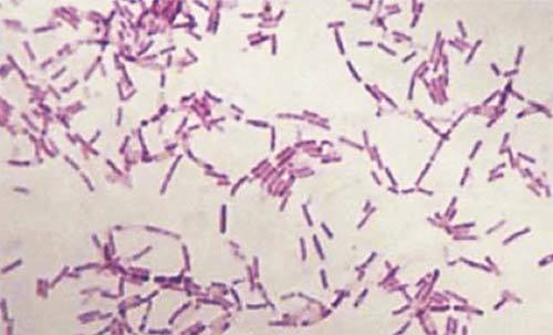 细菌|疯狂科学家为了永生，给自己注射350万年前的细菌，结果如何？