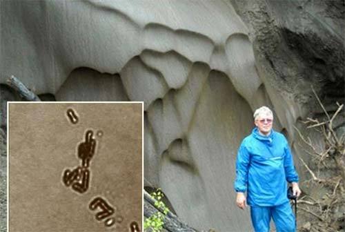 细菌|疯狂科学家为了永生，给自己注射350万年前的细菌，结果如何？