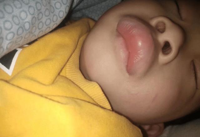 "表弟和我睡觉,结果嘴唇被蚊子咬了,"哈哈哈画面实太残忍了_腾讯新闻