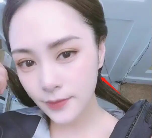 钟欣潼|阿娇伤好后直播，发福明显颜值气质下降，短发造型被嘲无星味