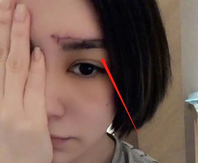 钟欣潼|阿娇伤好后直播，发福明显颜值气质下降，短发造型被嘲无星味