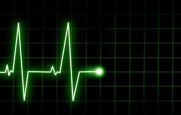 心脏停止跳动后人的意识还会持续科学家经研究已得出结论