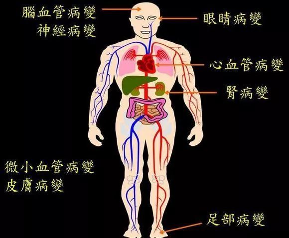 糖尿病的真相不是血糖高而是五臟六腑沒糖