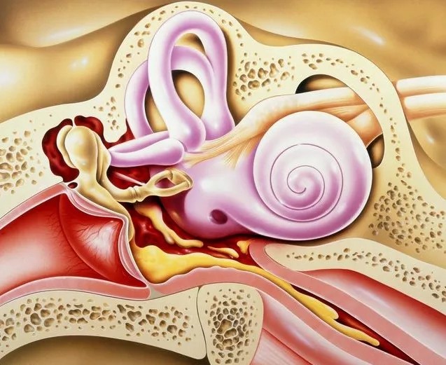 關於慢性化膿性中耳炎,你一定要知道這4點!