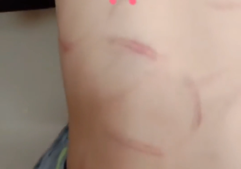 云南7岁男孩被继母用衣架抽伤亲妈报警父亲再犯就离婚告她