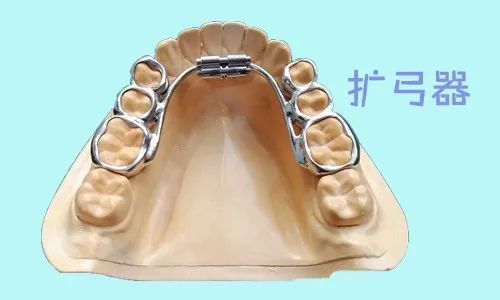 谁说的牙齿拥挤就一定要拔牙?不一定,用这3种方法,矫正照样不拔牙
