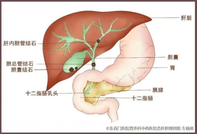 胆囊和胃的连接图图片