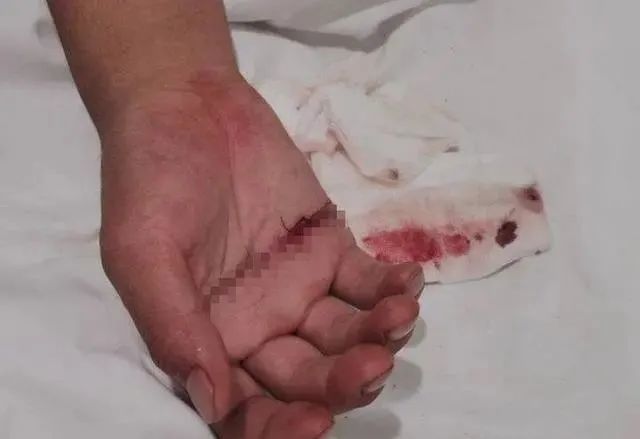 凌晨,烂尾楼里,夺下刀的他满手是血,却还在劝慰轻生男子_腾讯新闻