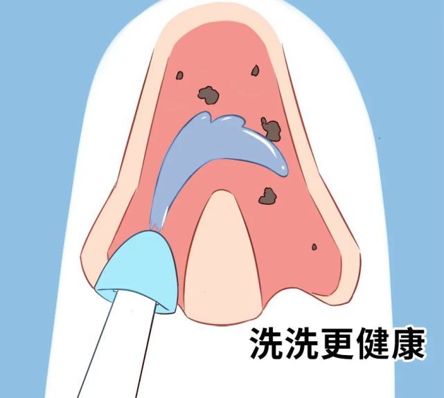 第一个洗鼻子的人,竟然是在练瑜伽!_腾讯新闻