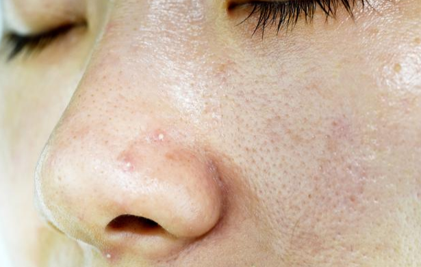 皮肤毛孔粗大似大妈,平时多做这4点,收缩毛孔皮肤细腻