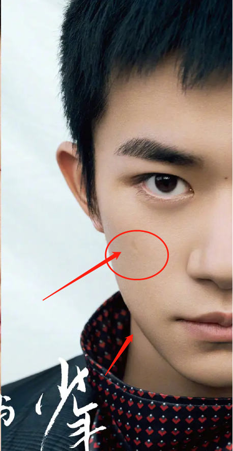 易烊千玺|易烊千玺半张脸杂志照曝光，皮肤状态差痘坑明显，被网友吐槽：丑