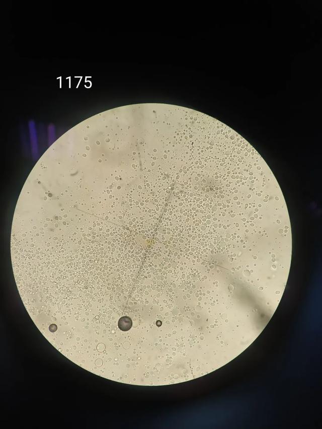显微镜下的毒蘑菇假球基鹅膏