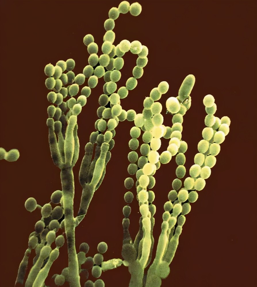 发明青霉素的弗莱明:取自己鼻涕粘液研究,仅70年救了上亿人